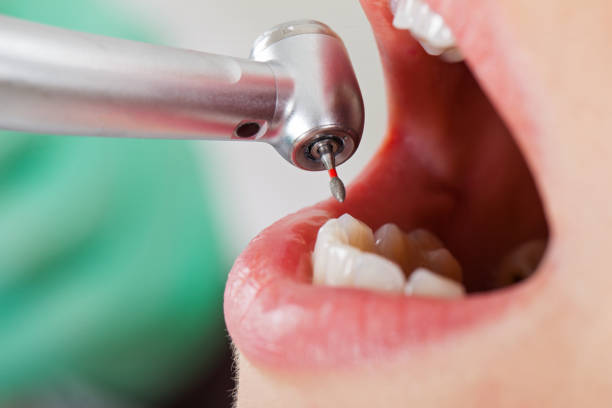 Best Emergency Dental Care for Sports Injuries in Red Oaks Mill, NY